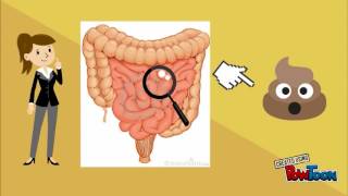 Ciclo de vida de strongyloides stercoralis [upl. by Aikram]