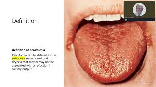 XEROSTOMIA TREATING DRY MOUTH TO IMPROVE PATIENT OUTCOMES [upl. by Lucine]