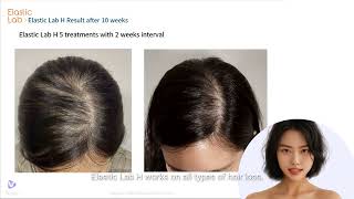 Elastic Lab H Innovative Hairbooster [upl. by Nwahsav893]