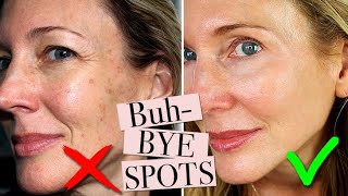 How To Get Rid of Age Spots [upl. by Yenetruoc]