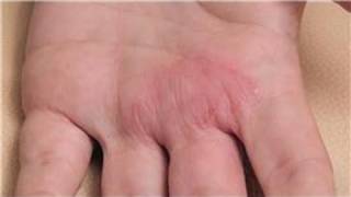 Dermatology Treatments  How to Diagnose Skin Rashes [upl. by Mabelle]