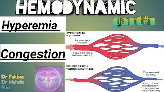 Hemodynamic disorder part  1 Hyperemia and congestion [upl. by Sonahpets171]