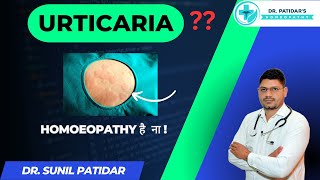 quotRelief from Urticaria Homeopathic Medicine by Dr Sunil Patidarquot [upl. by Retsevlis]