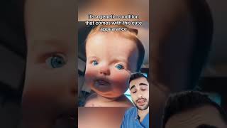 This is Called Waardenburg Syndrome🤯🤯Doctor Reacts [upl. by Allebram]