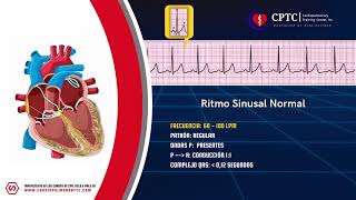 Ritmo Sinusal Normal [upl. by Maridel645]