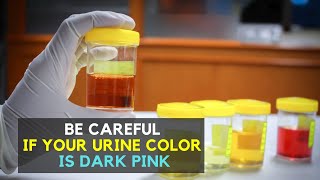 Be Careful if Your Urine Color is Dark Pink [upl. by Okoy]