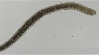 Para GIT  Hymenolepis Nana  Dwarf tape worm   الدودة القزمة [upl. by Littell]