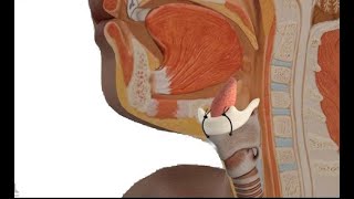 ThyroHyoid Approximation for Sleep Apnea [upl. by Larsen]