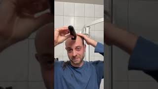 Balding Man Shocked By EPIC Transformation [upl. by Lewin]