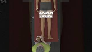 Iliac Outflare Assessment [upl. by Fennell432]