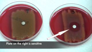 Bacitracin test for Streptococcus pyogenes [upl. by Freed]