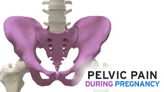 Pelvic Pain During Pregnancy [upl. by Ainitsirc660]