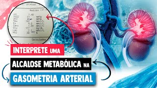 GASOMETRIA ARTERIAL de uma ALCALOSE METABÓLICA │ Medicina Resumida [upl. by Selbbep544]