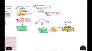 Myocardial Infarctionneetpg inicet fmge mbbs medicine ecgmadeeasy ecg [upl. by Yla]