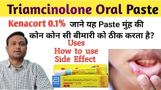 Kenacort 01  Kenacort gel how to use  Triamcinolone oromucosal paste bp 01 ww in hindi [upl. by Larson]