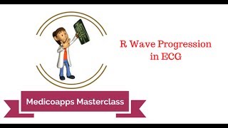 R Wave Progression on ECG [upl. by Annahaj480]