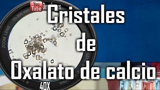 Cristales de oxalato de calcio monohidratado  Uroanalisis [upl. by Ydospahr]