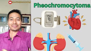 Pheochromocytoma  Cause Symptoms And Treatment  medicalpharmacology mbbs [upl. by Olegna844]