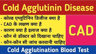 CAD in hindi  Cold Agglutinin Disease  Treatment Symptoms amp Price [upl. by Brandy]