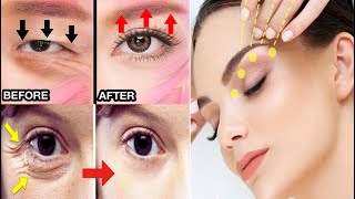 The Ultimate Guide To Fixing Droopy Eyelids Hooded Eye Crows Feet បំបាត់ភ្នែកស្លក់ភ្នែកយាធ្លាក់ [upl. by Vacla]