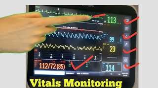 ICU Monitors Guide in hindi part 2  Vital Monitoring with Digital Monitor  How to Monitor Vitals [upl. by Katerina]