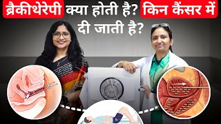 ब्रैकीथेरेपी क्या होती हैकिन कैंसर में दी जाती हैWhat is Brachytherapy Is Brachytherapy Painful [upl. by Nerehs739]