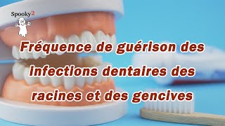 Fréquence de guérison des infections dentaires des racines et des gencives [upl. by Breger]