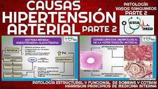 SINTOMAS DE HIPERTENSIÓN ARTERIAL FISIOPATOLOGÍA PARTE 2  GuiaMed [upl. by Aramo342]