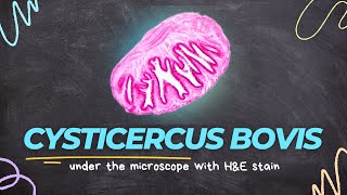 Cysticercus bovis under the microscope with Haematoxylin and Eosin HampE stain [upl. by Nnasus]