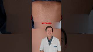 🦠 Le Pityriasis Versicolor  une infection cutanée superficielle bénigne 📚 [upl. by Norra]