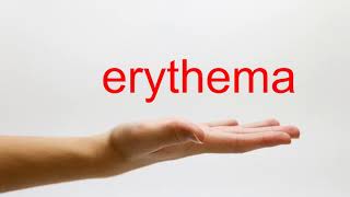 How to Pronounce erythema  American English [upl. by Rramed]