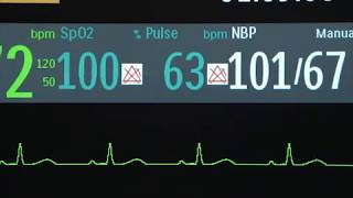 Efficia DFM100 Monitoring 37 [upl. by Aivato247]