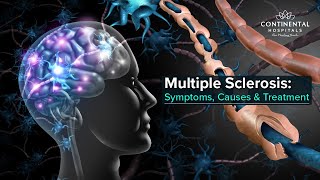 Multiple Sclerosis MS Symptoms Causes amp Treatment  Continental Hospitals [upl. by Marna891]