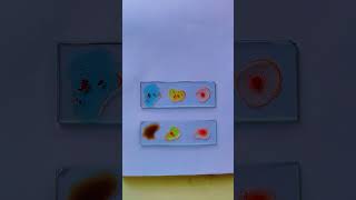 Blood group  ABO blood group youtube youtubeshorts labstaff labtechnician mlt nursingstudent [upl. by Hurff]