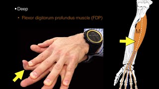 Forearm flexor muscles [upl. by Calise]