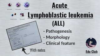 ALL Acute Lymphoblastic LeukemiaLymphoma  Disorders of White Cells  Lymphoid neoplasm Pathology [upl. by Ebonee295]