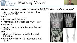 Differential Diagnosis for Chronic Wrist Pain [upl. by Elleuqram]