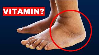 1 Vitamin vitamin that helps reduce swelling [upl. by Collette912]