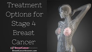 What Are the Treatment Options for Stage 4 Breast Cancer [upl. by Rycca43]