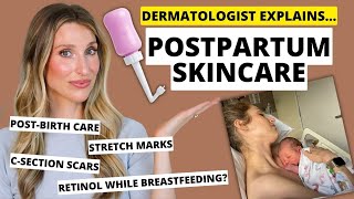 Dermatologist Explains Postpartum Skincare Stretch Marks CSections BreastfeedingSafe amp More [upl. by Cailly704]