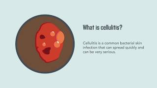 Cellulitis Causes Symptoms Diagnosis and Treatment  Merck Manual Consumer Version Quick Facts [upl. by Alyn]