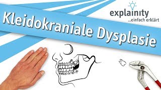 Kleidokraniale Dysplasie einfach erklärt explainity® Erklärvideo [upl. by Donahoe]