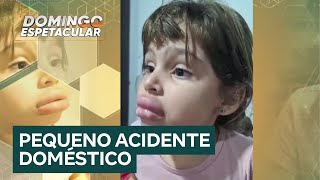 Menina de 5 anos fica com os lábios inchados após prender a boca em tampa [upl. by Bart]