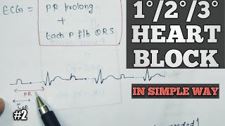 FirstsecondThird degree heart block  Cardiac arrhythmia in hindi  Av block  2 [upl. by Aisor]