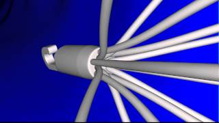 Simulation of Inferior Vena Cava IVC Filter Deployment and Blood Flow in a PatientSpecific Model [upl. by Allegna]