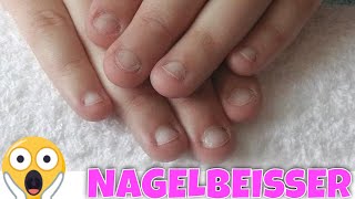 NAGELBEISSER EXTREM 😱 Tipps undAnleitung für Gelnägel Modellage  Lyninails [upl. by Repsac380]