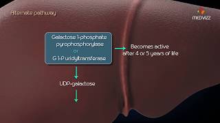 Metabolism of galactose Classic Galactosemia Galactokinase deficiency [upl. by Lander]