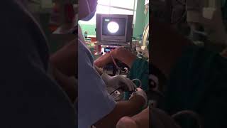 Cystoscopy [upl. by Treacy253]