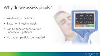 Pupillometry and NPi® in the Neuro ICU [upl. by Obel]