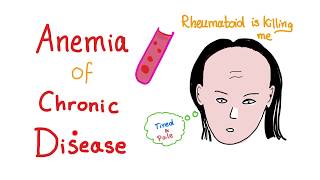 Anemia of Chronic Disease  Anemia of Inflammation All you need to know  Hematology Series [upl. by Ecille916]